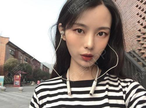 娱乐圈吃瓜水母头,揭秘“水母头”现象背后的秘密